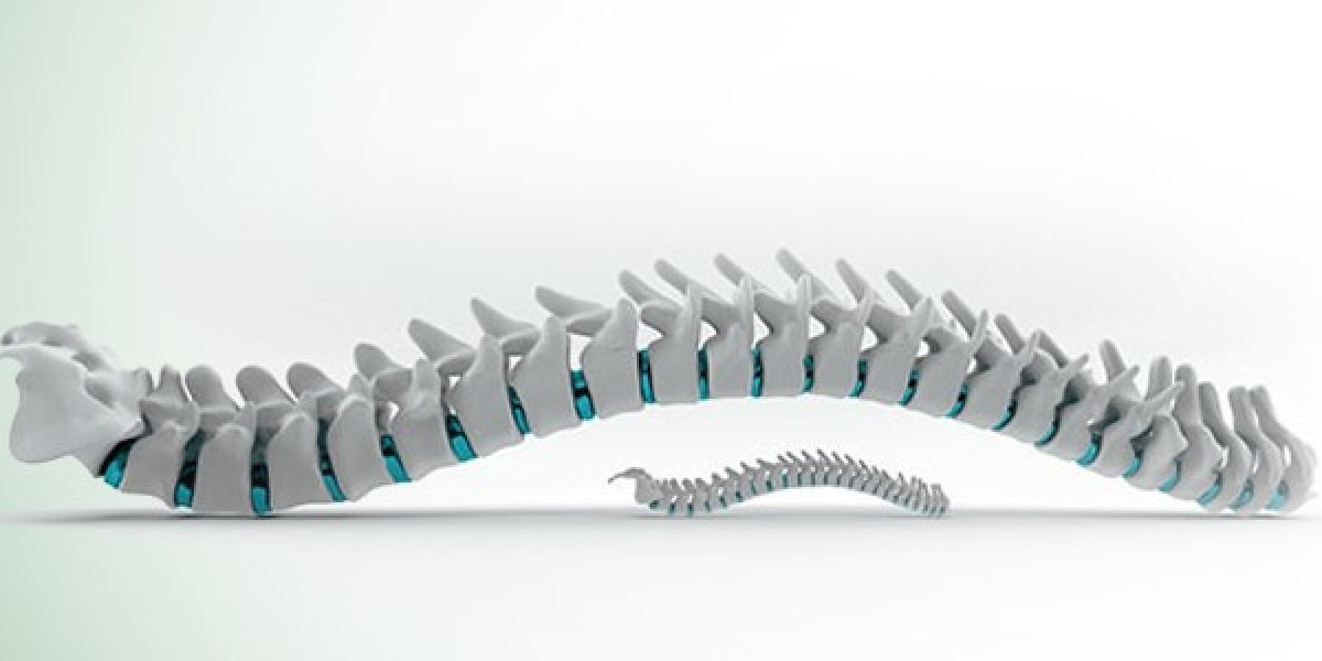 Pioneering Spine Care: The Role of Expertise in Spine Surgery Hospitals