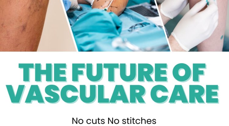 Discovering Healthier Legs: How to Find the Best Vascular Surgeon UAE for Your Needs - Bip America