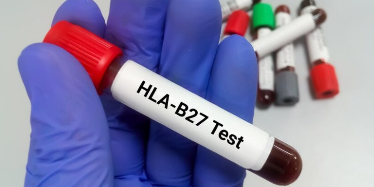 HLA B27 Test: Purpose, Procedure, Interpretation & Cost in India