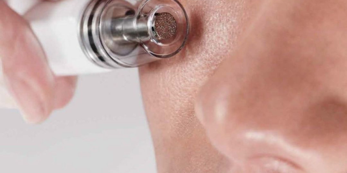 Experience Ultimate Skin Rejuvenation and Laser Hair Removal at PURE Medical Spa