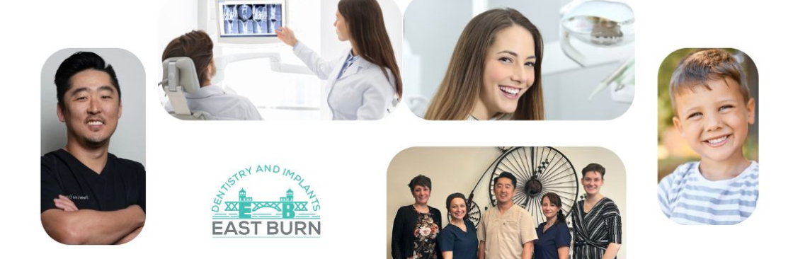 East Burn Dentistry Implants Cover Image