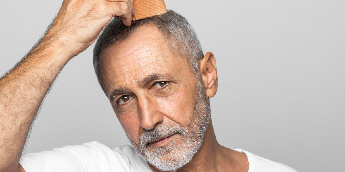 What Are the Early Signs of Androgenetic Alopecia? 
