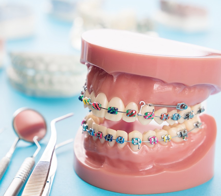 Blogs - Bang Box online - Straighten Your Smile with Confidence: Why You Should Visit an Orthodontist in Vancouver